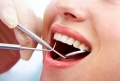 Giá trồng răng giả Implant bao nhiêu tiền?