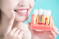 Bao nhiêu tuổi thì trồng răng Implant được?