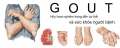 Tìm hiểu về bệnh gout và nguyên nhân của bệnh gout