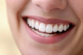 Trồng răng Implant All on 4 và những điều cần biết