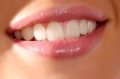 Giải đáp: Trồng răng giả có mấy loại?