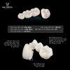 Bọc răng sứ Diamond Dream lựa chọn hoàn hảo cho thẩm mỹ răng công nghệ 4.0