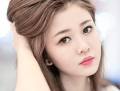 Tạo má lúm đồng tiền bao lâu thì lành