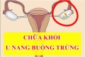 Tuyển nhân viên Partime thu nhập không giới hạn